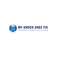 My Knock Knee Fix image 1