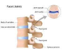 Arthritis Pain Management & Relief image 2