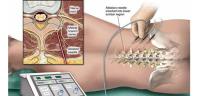 Arthritis Pain Management & Relief image 4