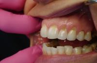 Periodontics and Dental Implants of North Carolina image 2
