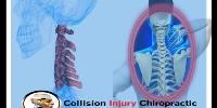Collision Injury Chiropractic image 5