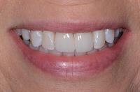 Dyme Dental LLC image 2