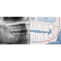 Implants & Oral Surgery of Chattanooga image 4