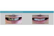 Smiley Dental & Orthodontics image 5
