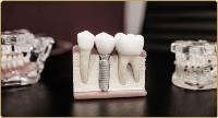 Brentwood Dental Spa image 4
