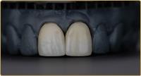 Brentwood Dental Spa image 3
