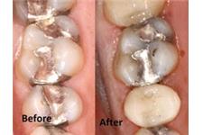 Azalea Dental image 3