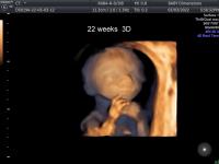 Baby Dimensions image 3