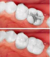 Ocoee Dental And Orthodontics image 11