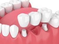 Ocoee Dental And Orthodontics image 13