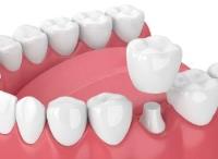 Ocoee Dental And Orthodontics image 15