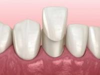 Ocoee Dental And Orthodontics image 19