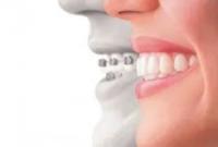 Ocoee Dental And Orthodontics image 3