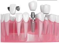 Innovative Dental & Orthodontics image 24