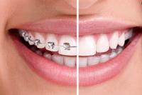 Ocoee Dental And Orthodontics image 33