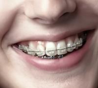 Ocoee Dental And Orthodontics image 35