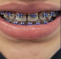 Ocoee Dental And Orthodontics image 36