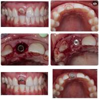 Ocoee Dental And Orthodontics image 37