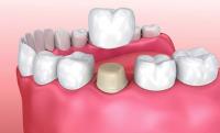 Innovative Dental & Orthodontics image 10