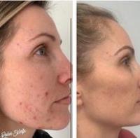 Fine Skin Dermatology image 1