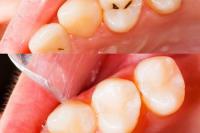 Blue Cedar Dentistry image 5