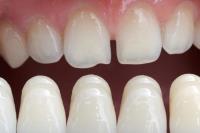 Blue Cedar Dentistry image 6