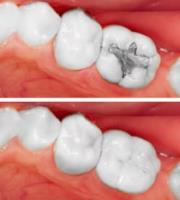 Your Dentistry of Morgan Hill image 14