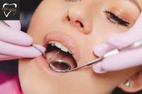 Root canal treatment cost in Pune image 4