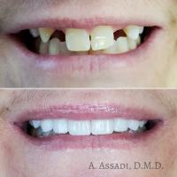Inspire Dental of Alexandria image 5