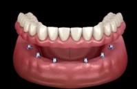 Arlington Dental Excellence image 12