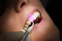 Arlington Dental Excellence image 23