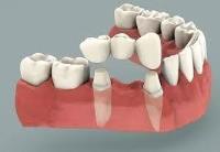 Lansdowne Family Dental image 9
