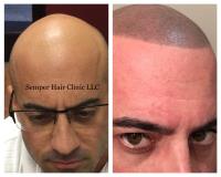 Semper Hair Clinic LLC image 5