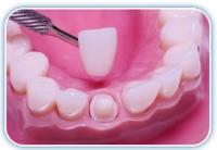 Gardena Dental Group image 14