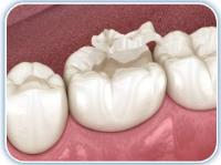 Gardena Dental Group image 15
