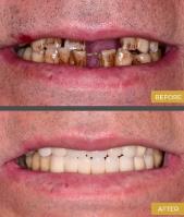 Shahbazyan DDS Cosmetic & General Dentistry image 4