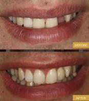Shahbazyan DDS Cosmetic & General Dentistry image 2