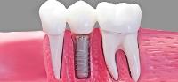 Covington Complete Dentistry image 9