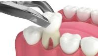 Covington Complete Dentistry image 15