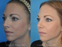 North Texas Facial Plastic Surgery image 3