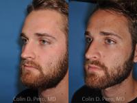 North Texas Facial Plastic Surgery image 4