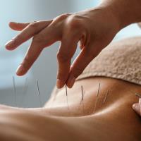 Body Mind Wellness Acupuncture PC image 3