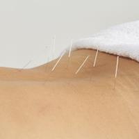Body Mind Wellness Acupuncture PC image 4