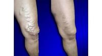 USA Vein Clinics image 1