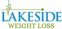 Lakeside Weight Loss image 3