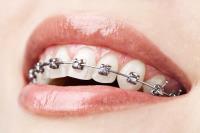Calismile Orthodontics image 3