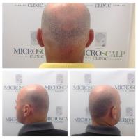Micro Scalp Clinic image 4