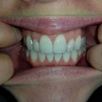 Wermerson Orthodontics image 5
