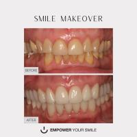 Empower Your Smile DDS image 1