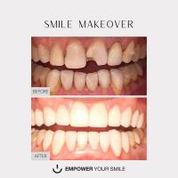 Empower Your Smile DDS image 4